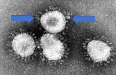 Статья Тайлера Лебарона о терапии коронавируса молекулярным водородом